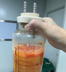 泰州水动力吸脂手术要做多久？